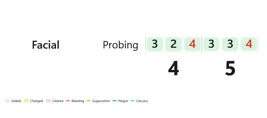 The HUD: the probing just said for teeth 4 and 5, in large type
