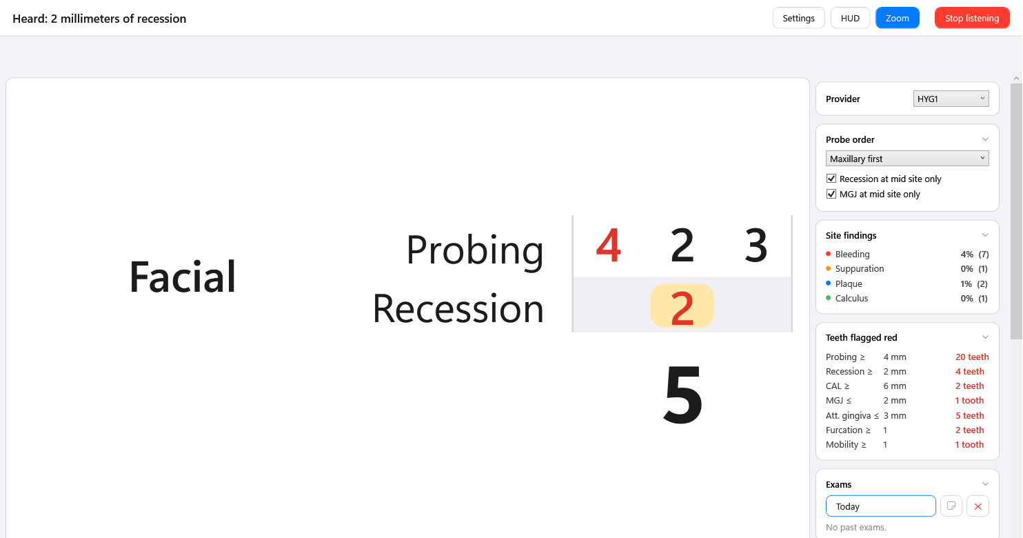 Zoom: the perio window with the last change, a recession of 2 on tooth 5, shown large over the chart